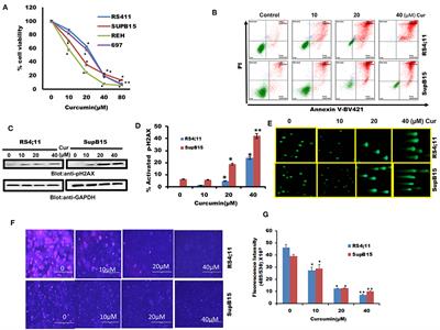 Curcumin Induces Apoptotic Cell Death via Inhibition of PI3-Kinase/AKT Pathway in B-Precursor Acute Lymphoblastic Leukemia